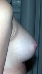 chirurgie-esthetique-interventions-seins-augmentations-mammaires-036