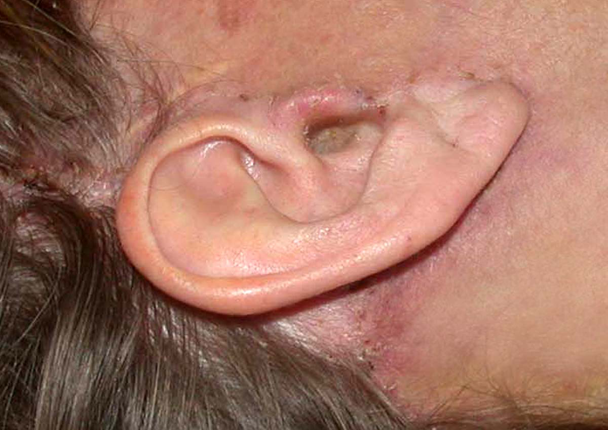 chirurgie-esthetique-interventions-visage-liftings-022