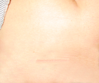 chirurgie-esthetique-tatouages-2