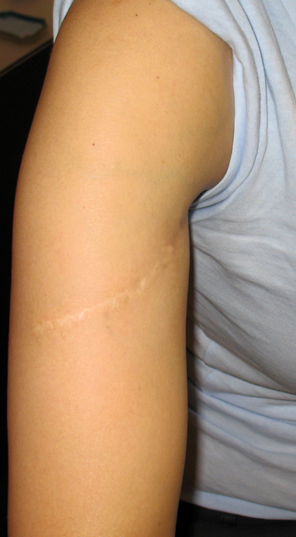 chirurgie-esthetique-cicatrices-grains-beauté01